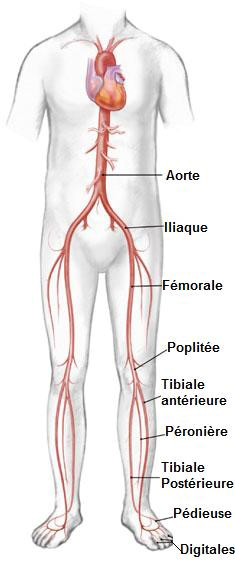 Définition Artériopathie