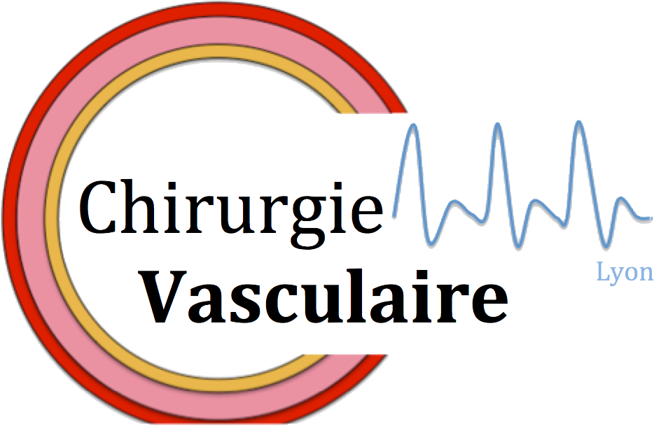Chirurgie Vasculaire Lyon 69