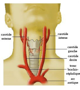 Anatomie artérielle