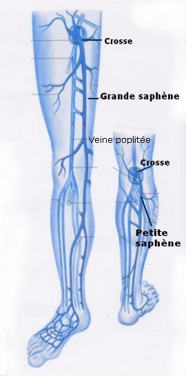 Symptômes Artériopathie - Diagnostic Artériopathie